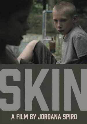 cortometraje skin
